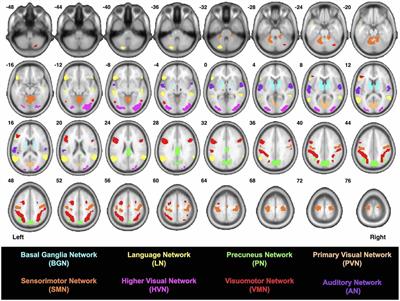 Probabilistic White Matter Atlases of Human Auditory, Basal Ganglia, Language, Precuneus, Sensorimotor, Visual and Visuospatial Networks